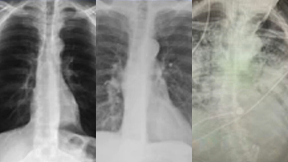 X-Rays in Space: A New Diagnostic Frontier