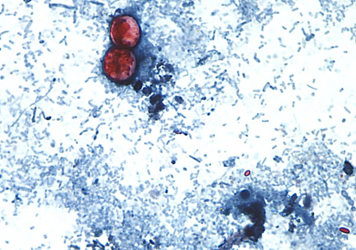 A photomicrograph of a *Cyclospora cayetanensis* oocysts