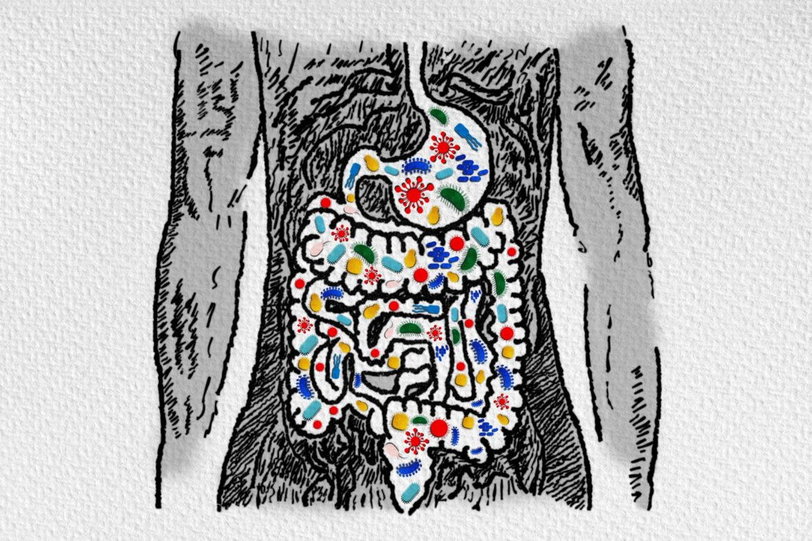 Microbiota Dysbiosis Linked to Intestinal Cancer Stemness in New Study
