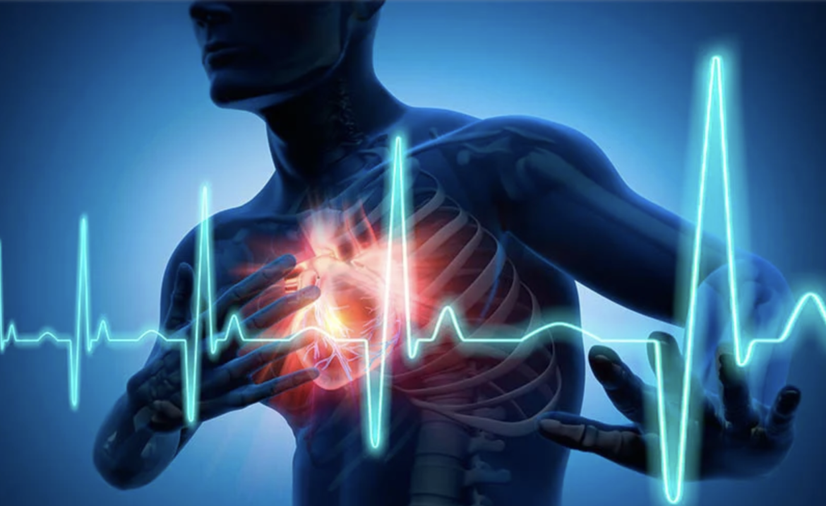 Heart Calcium Tests May Have Limited Value, Intermountain Study Finds
