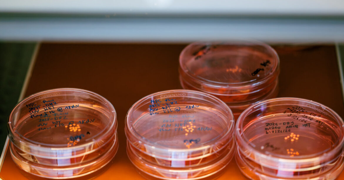 A stack of lab dishes containing lab-grown human brain organoids