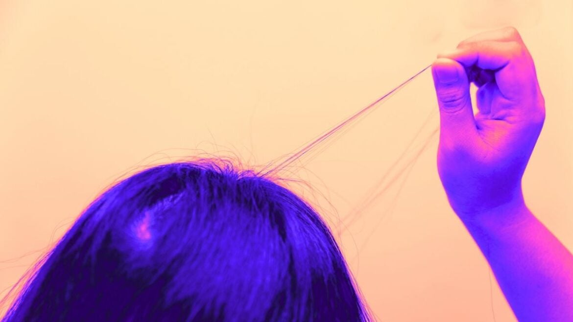 Trichotillomania Linked to Boredom and Tiredness, Not Emotional Distress