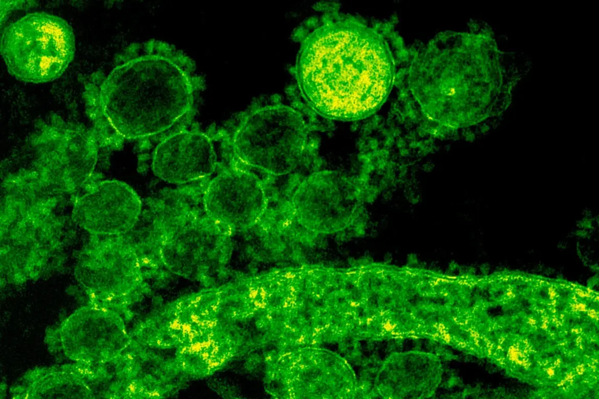 Severe COVID-19 Reactivates Dormant Viruses and Drives Long COVID