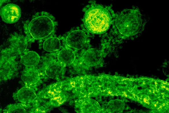 Severe COVID-19 Reactivates Dormant Viruses and Drives Long COVID