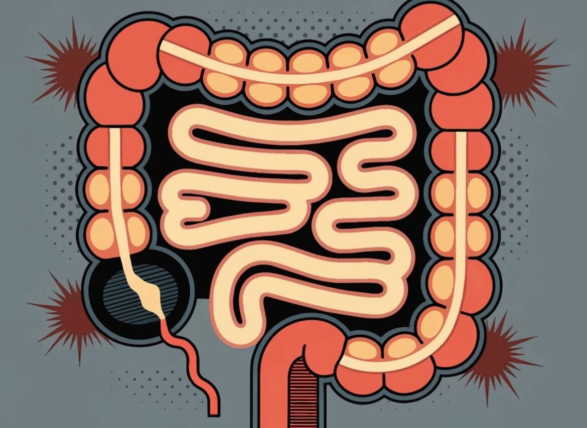 Early-Onset Cancers Rise in Under-50s: Symptoms and Screening Advice