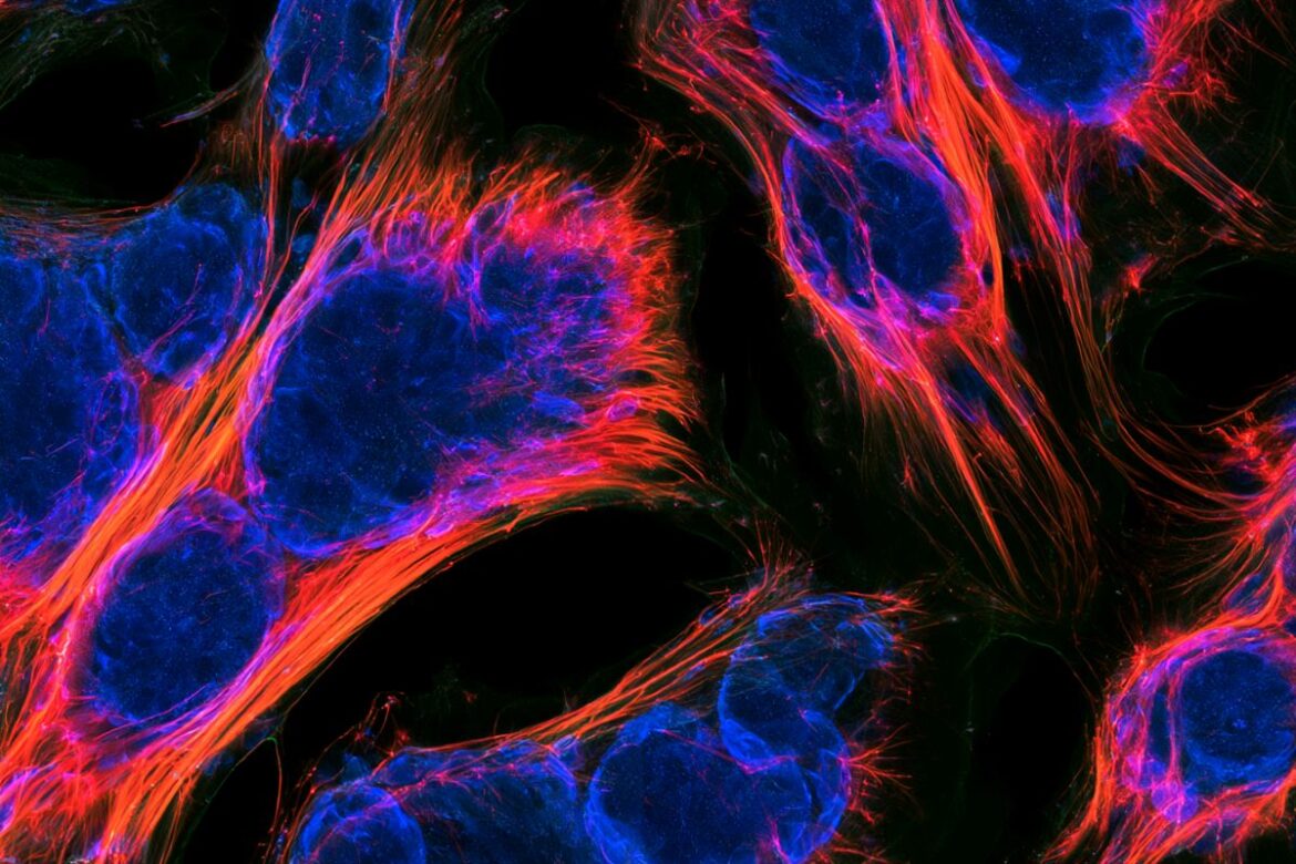 TRF2 Protein Key to Maintaining Muscle Stem Cell Identity and Repair