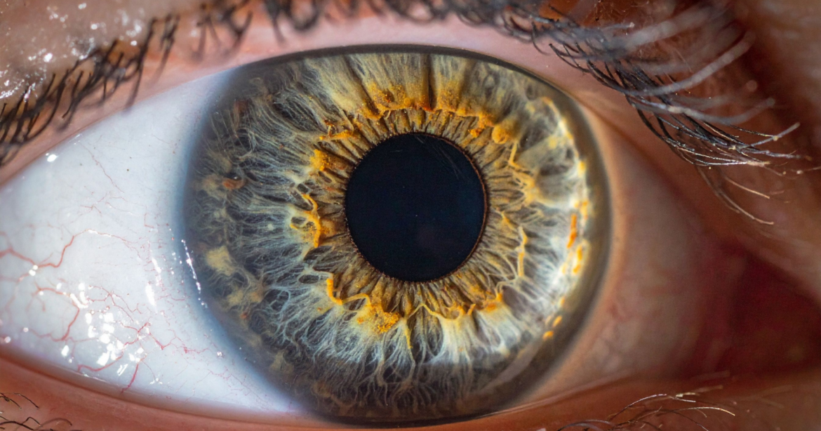 In 2017, a young woman glanced at a solar eclipse for only a handful of seconds, and days later doctors found the exact