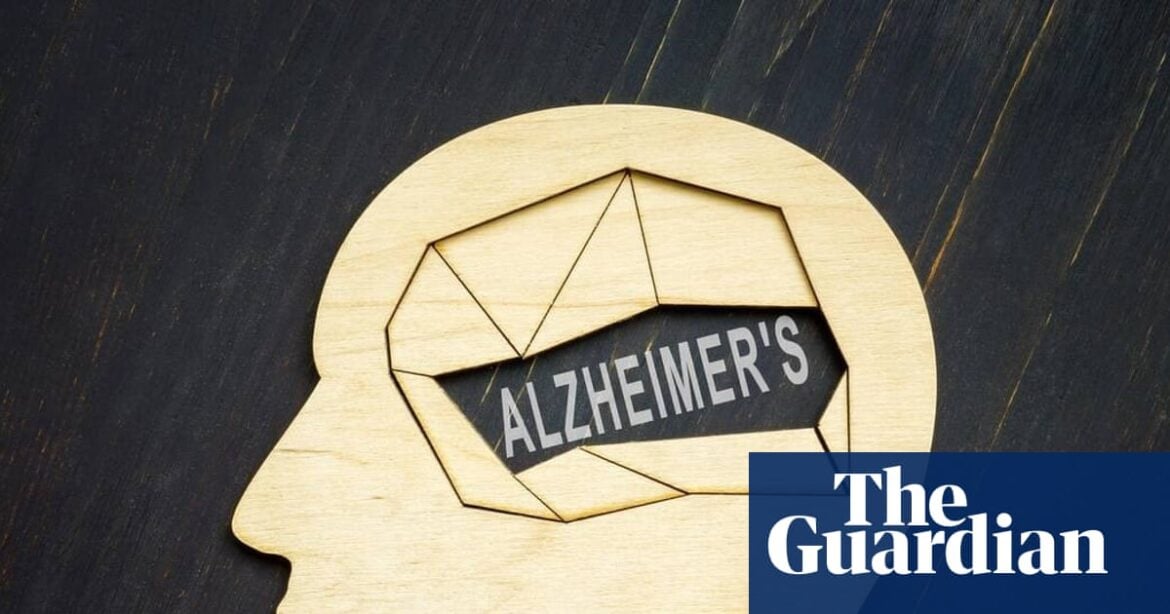 Trontinemab Trial: UK Patients Among First to Test Alzheimer's Prevention Drug