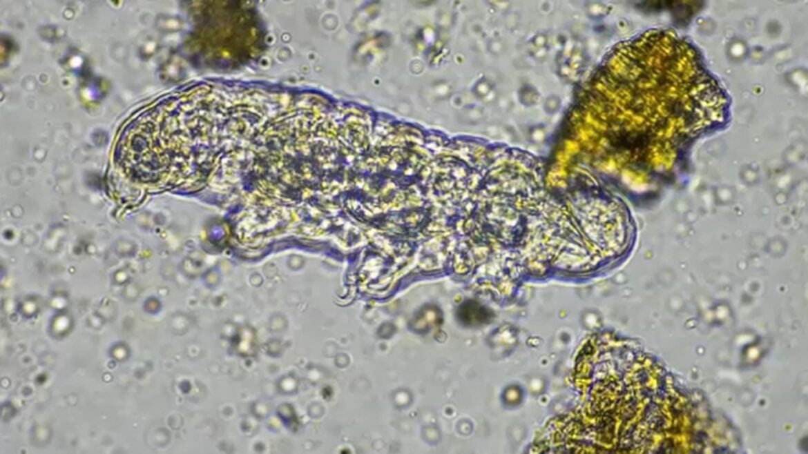 NC Teen Dies After Contracting Rare Brain-Eating Amoeba in Freshwater