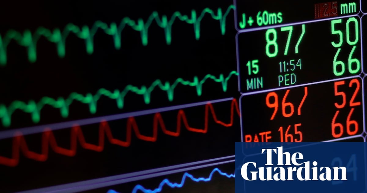 Severe Mental Illness Linked to 15-20 Year Shorter Life Expectancy in England