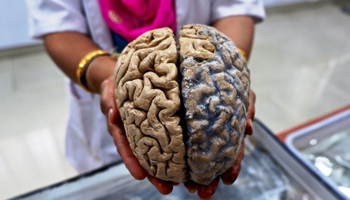 Human Brain Evolved as Two Separate Systems, Stanford Research Reveals