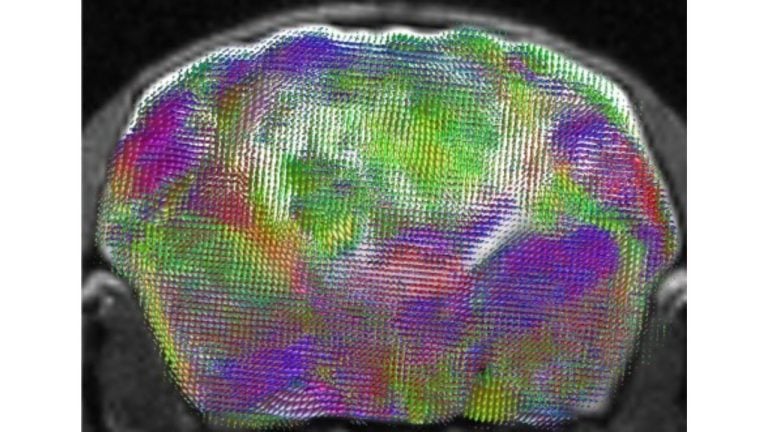 Human Brain Cells Integrate Deeply into Mice in Major Stanford Study