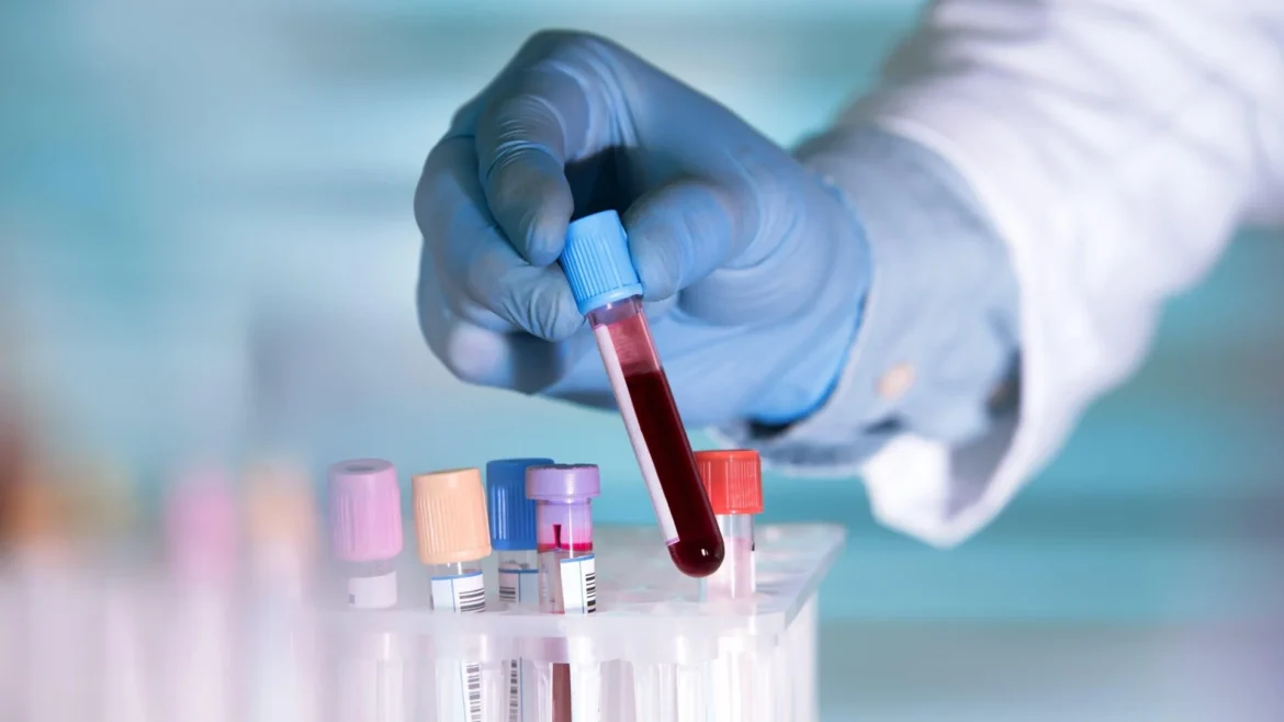 AI Drug Rentosertib Reverses Aging Markers in Clinical Trial