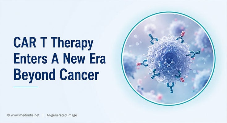 CAR T Cell Therapy Moves Beyond Cancer Into Autoimmune Disease