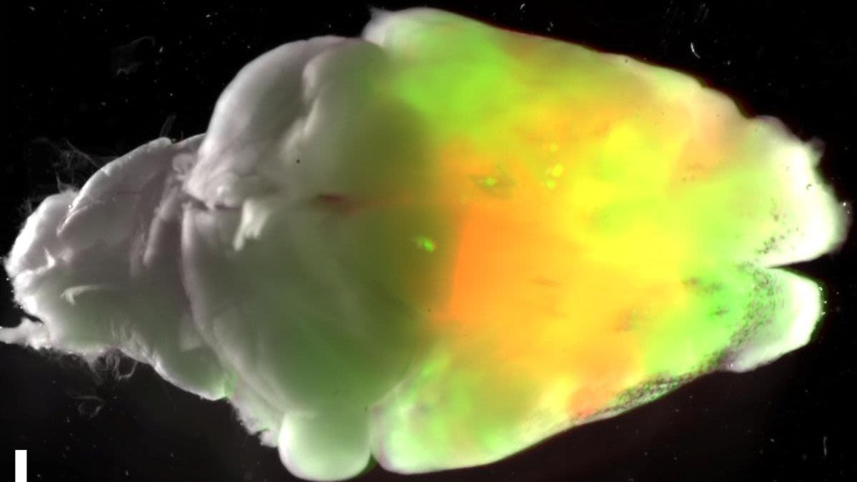Stanford Scientists Transplant Human Brain Tissue Into Engineered Mice