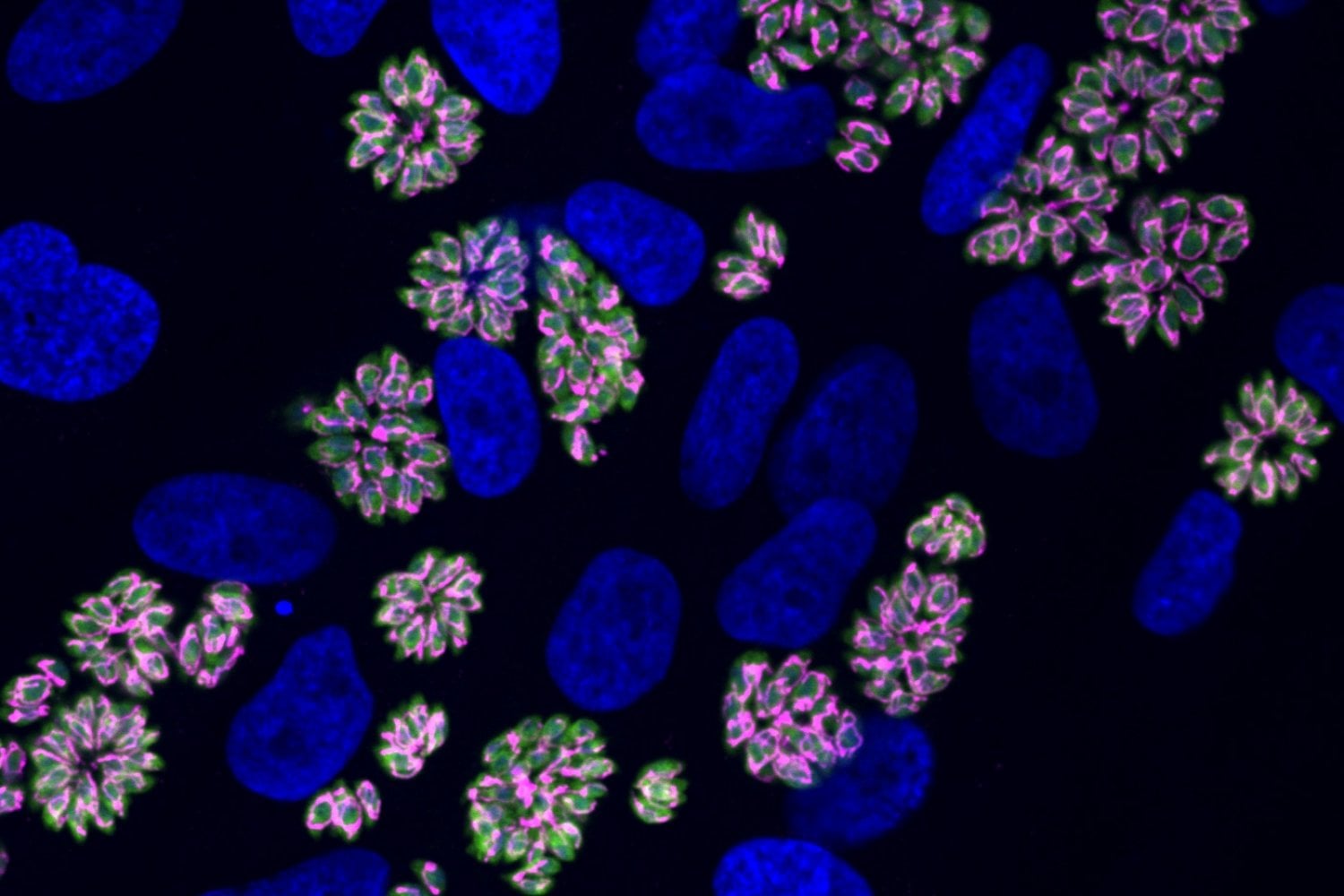 Toxoplasma Parasite Remodels Host Cell Surfaces to Trigger Invasion