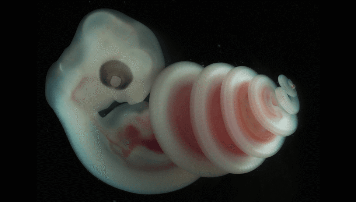 Baby Snakes Spiral As Embryos. We Didn’t Know Why, Then Scientists Discovered A Structure We Had Never Seen In An Animal