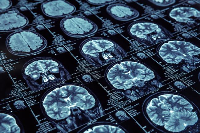 EPFL Researchers Map 539 Distinct Lipid Regions in Mouse Brain