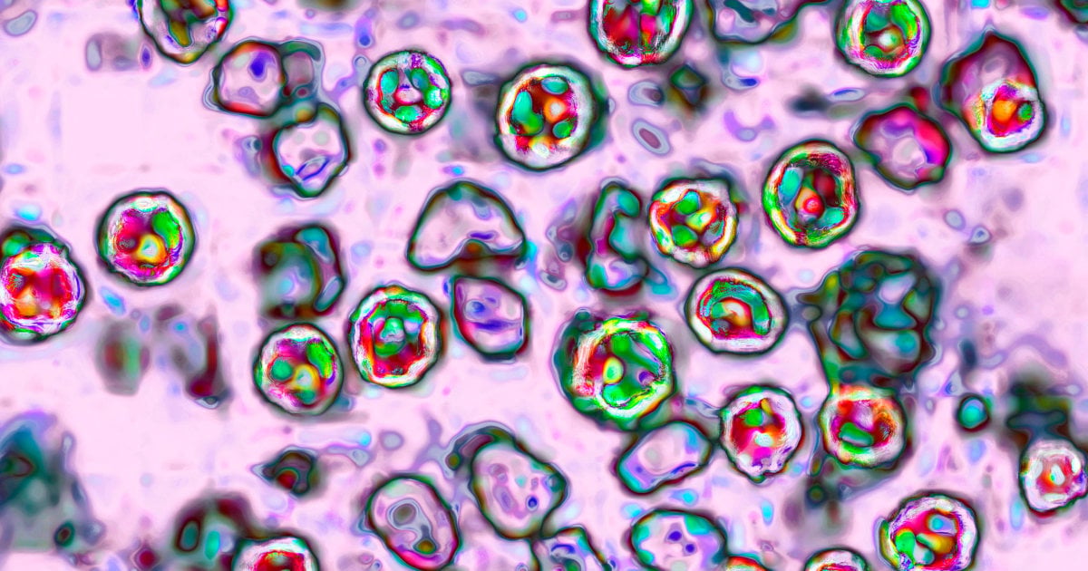 Pennsylvania Measles Outbreak Hits 1,100 Cases and Spreads to Schools