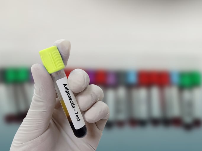 Study Finds Psoriasis Linked to MASLD Through Serum Adiponectin Levels