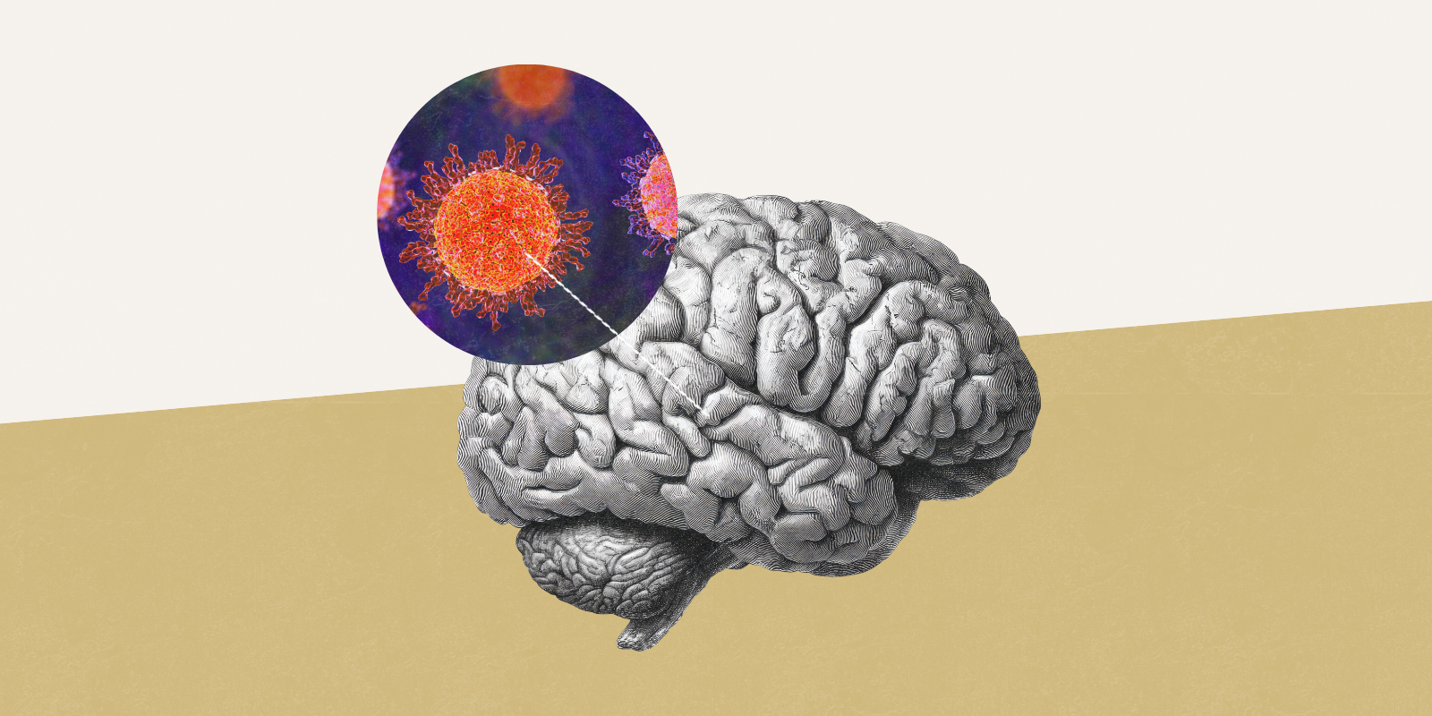 Graphic of a brain with a circle above it of microscopic viruses