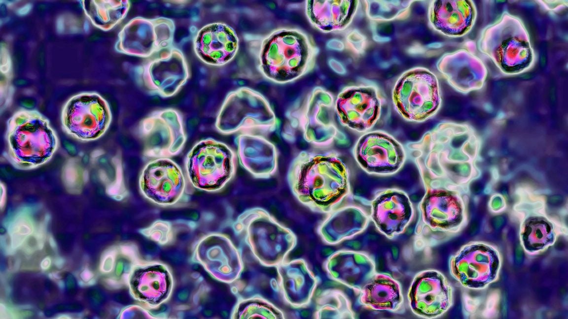 Franklin County Coroner: Woman is Pennsylvania's Sixth Measles Fatality
