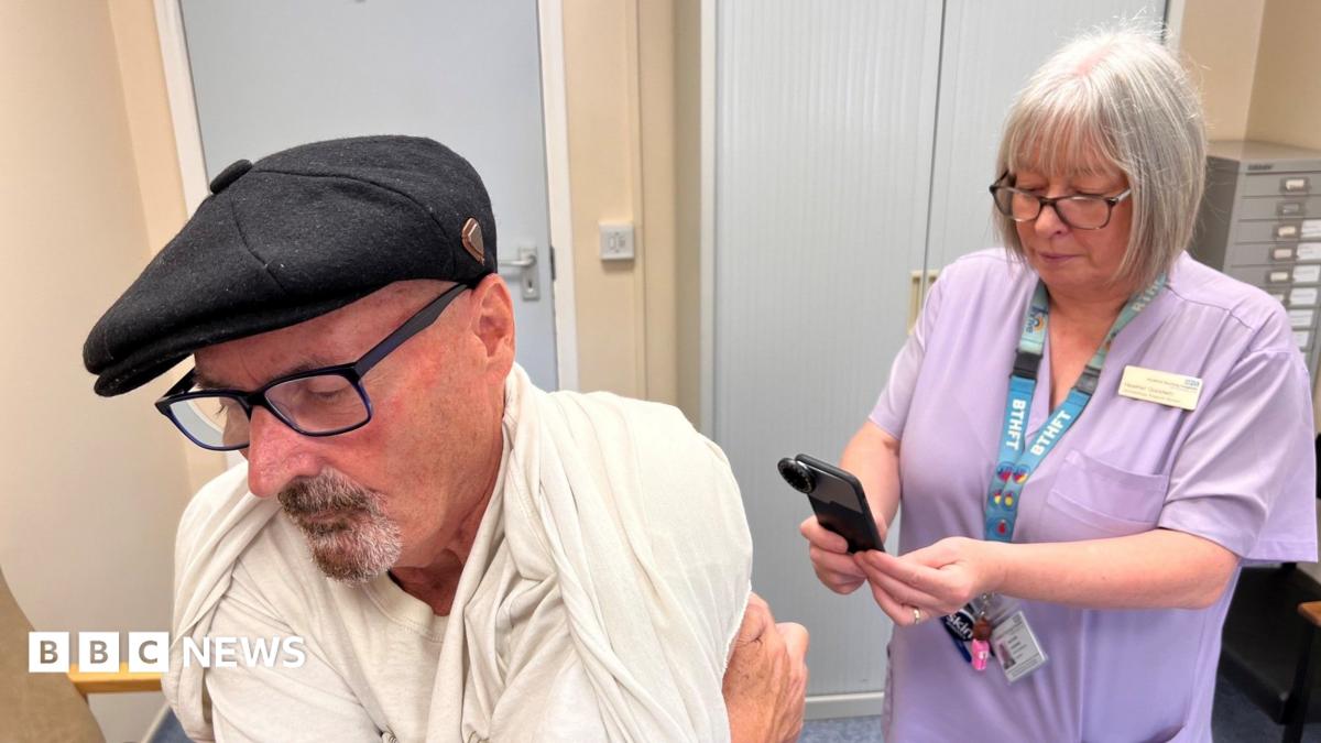 A man in his seventies who is wearing a black flat cap and glasses is lifting up his shirt to reveal his back. A healthcare