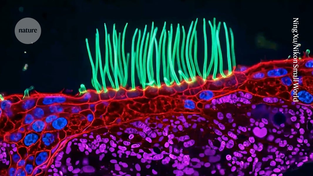 Experts Question Biological Accuracy of Nikon Contest Winner