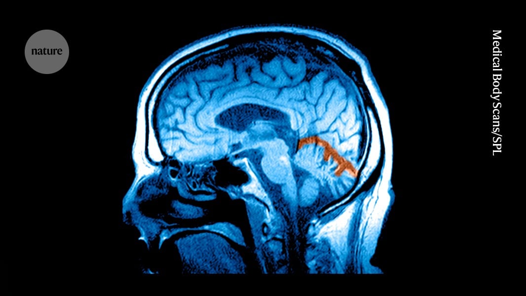 Retatrutide Patients Lose Up to 30 Percent of Body Weight in Trials